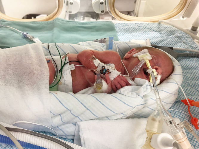 1.9lbs of Pure Sass: Axel's NICU Story