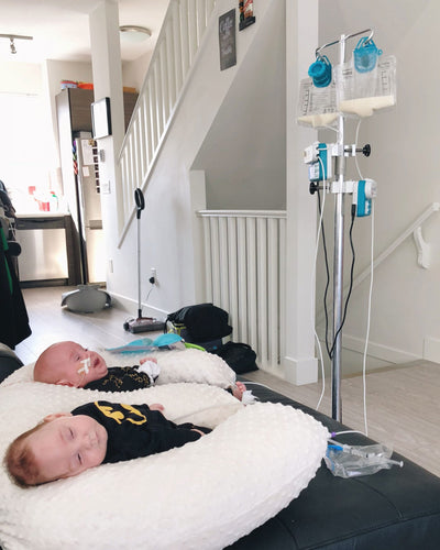 What Tube Feeding Our Complicated Twins is Like
